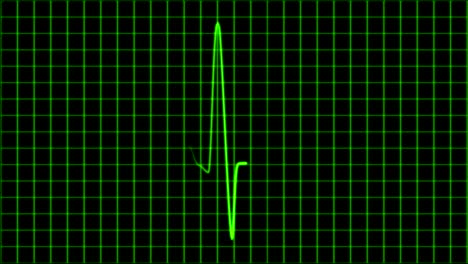 Kardiogramm-Kardiograph-Oszilloskop-Bildschirmschleife-4k